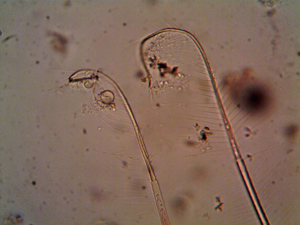 Close-up view of microorganisms under a microscope showcasing complex structures.